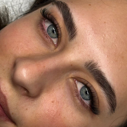 Fresh glowing skin after a Destiny Aesthetics treatment